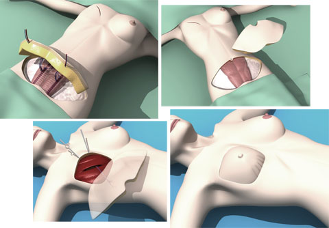 Plastic Surgery Nowadays