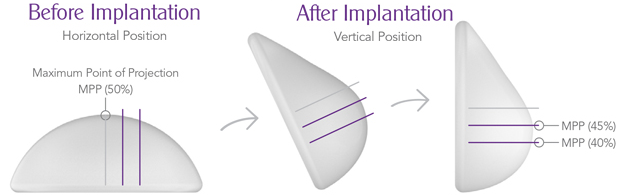 Plastic Surgery Nowadays