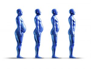 Operations For Diabetes Type 2